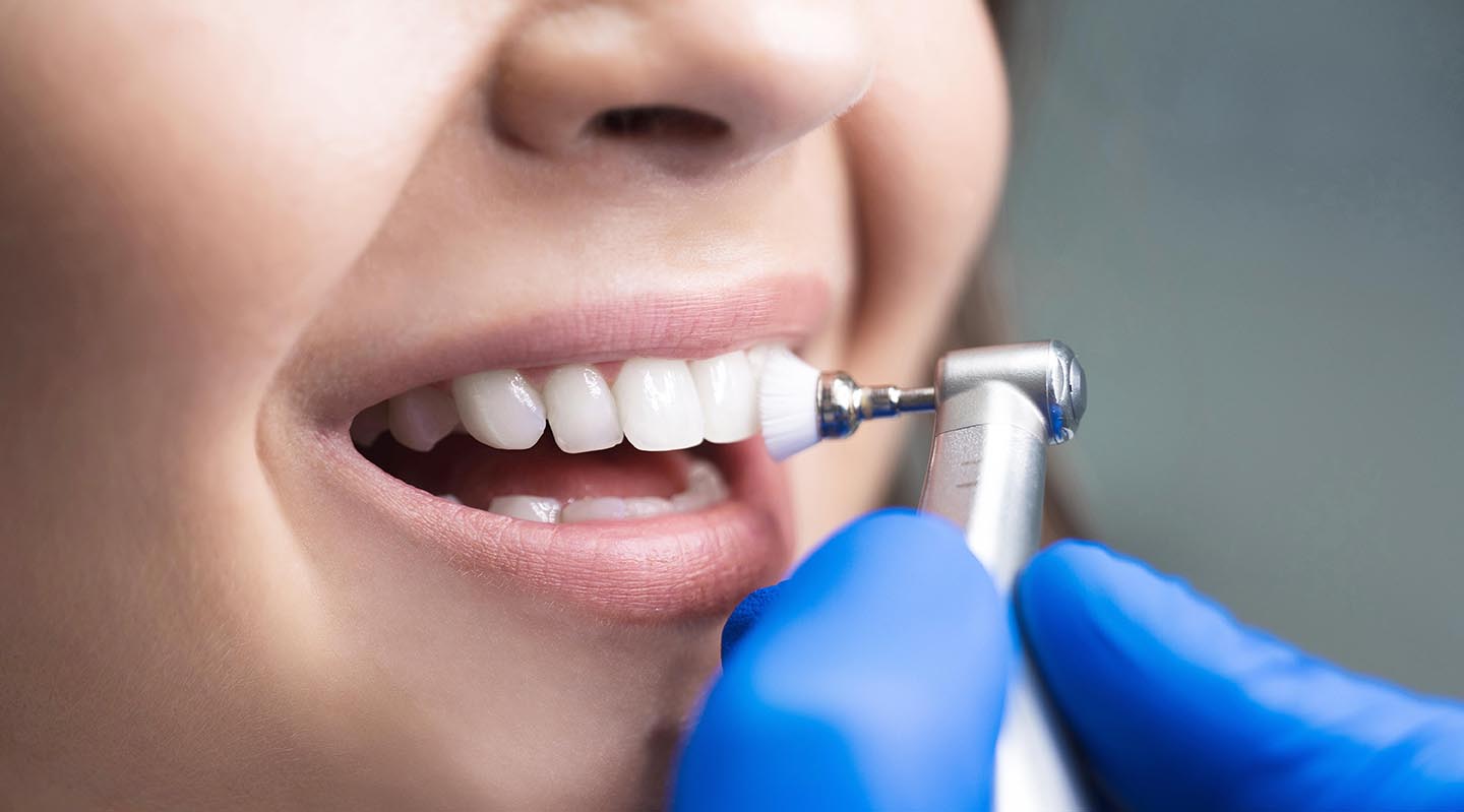 Patientin mit schönen und gesunden Zähnen dank einer professionellen Zahnreinigung in unserer Zahnarztpraxis in Essen-Heidhausen.